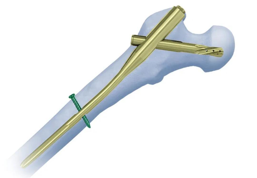 Trauma, bone, muscle and joint injury care